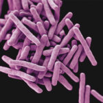 tuberculosis bacteria